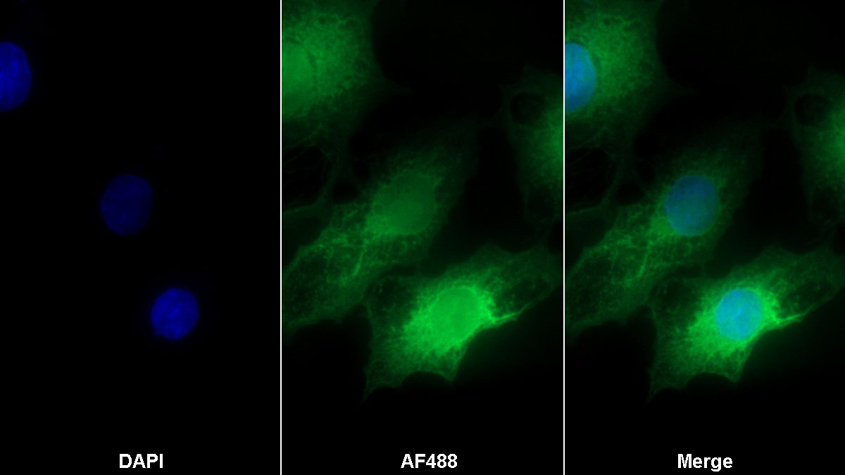 Polyclonal Antibody to Cytoplasmic Antiproteinase 3 (CAP3)