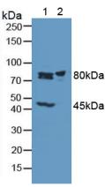 Polyclonal Antibody to Phosphofructokinase, Muscle (PFKM)