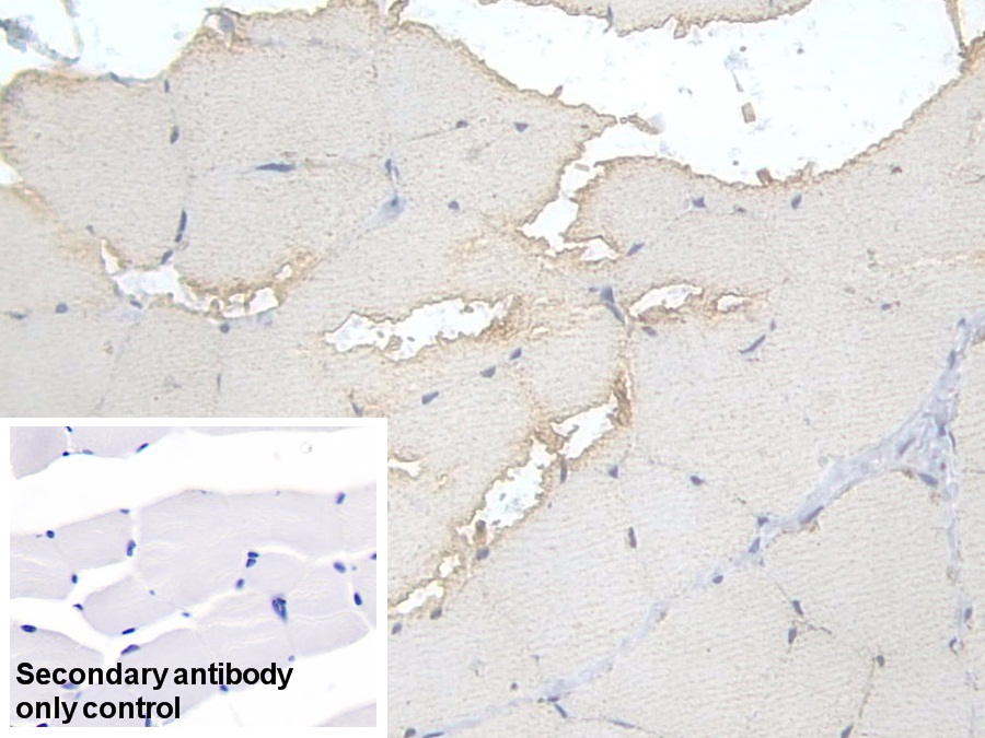 Polyclonal Antibody to Phosphofructokinase, Muscle (PFKM)