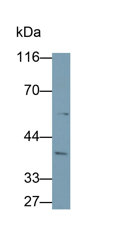 Polyclonal Antibody to Dickkopf Related Protein 3 (DKK3)