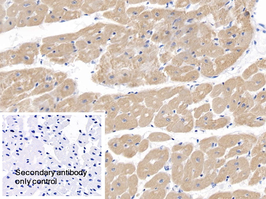 Polyclonal Antibody to Myosin Heavy Chain 7, Cardiac Muscle, Beta (MYH7)