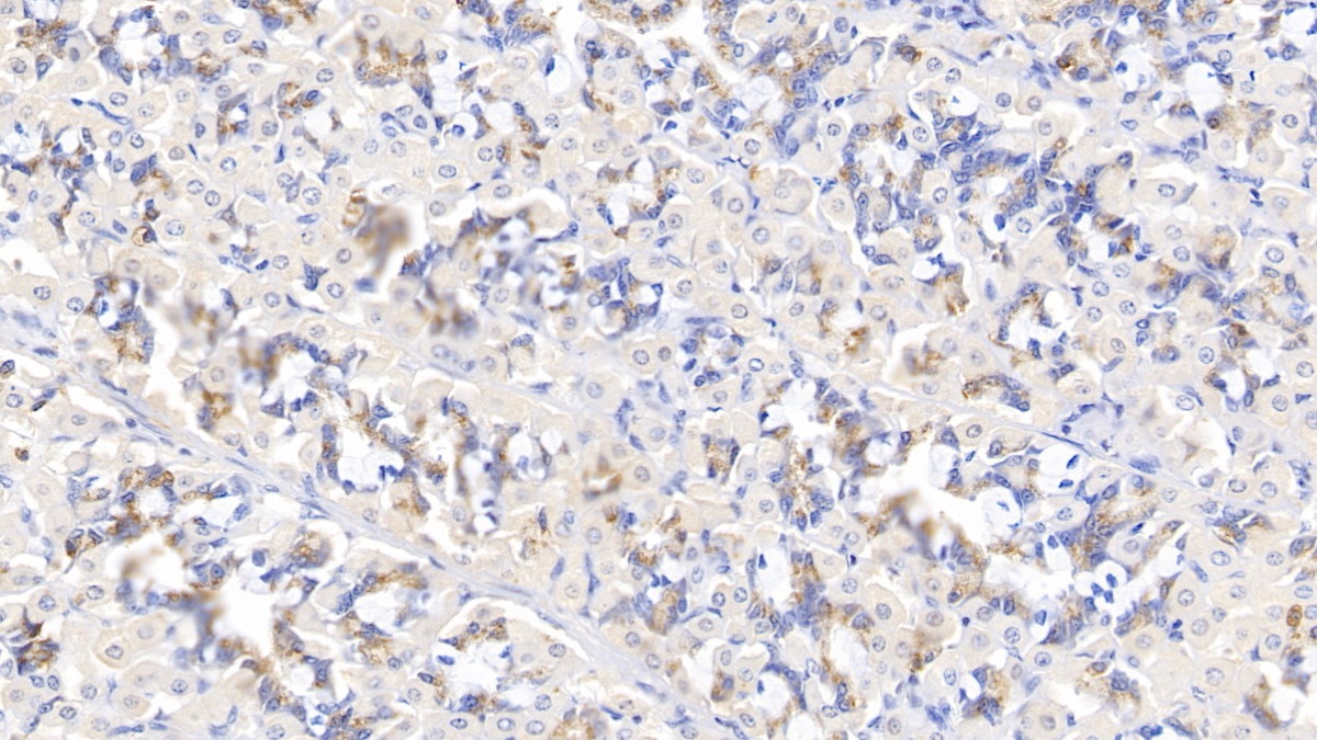 Polyclonal Antibody to Myosin Heavy Chain 9, Non Muscle (MYH9)