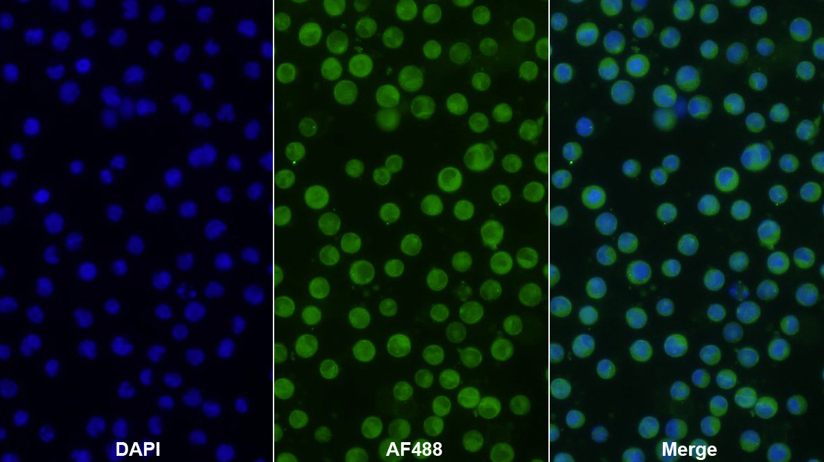 Polyclonal Antibody to Myosin Heavy Chain 9, Non Muscle (MYH9)
