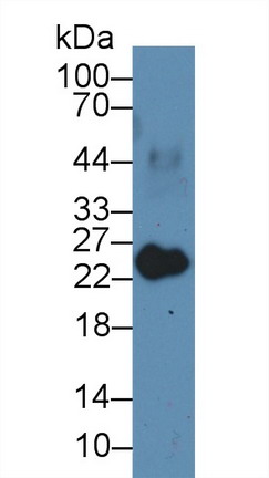 Polyclonal Antibody to Myosin Light Chain 3, Alkali, Ventricular, Slow Skeletal (MYL3)