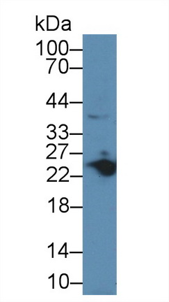 Polyclonal Antibody to Myosin Light Chain 3, Alkali, Ventricular, Slow Skeletal (MYL3)