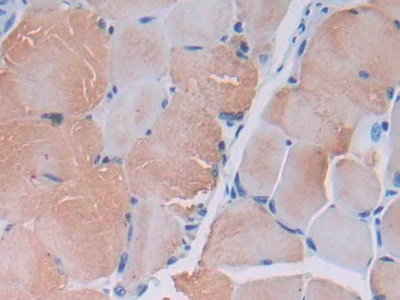 Polyclonal Antibody to Myosin Light Chain Kinase 2 (MYLK2)