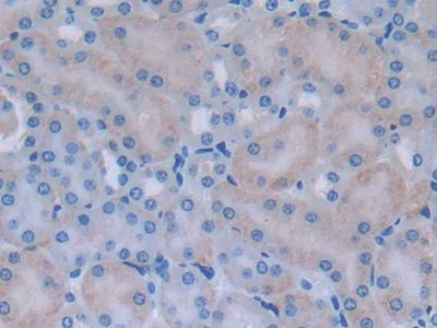Polyclonal Antibody to Myosin Light Chain Kinase 2 (MYLK2)