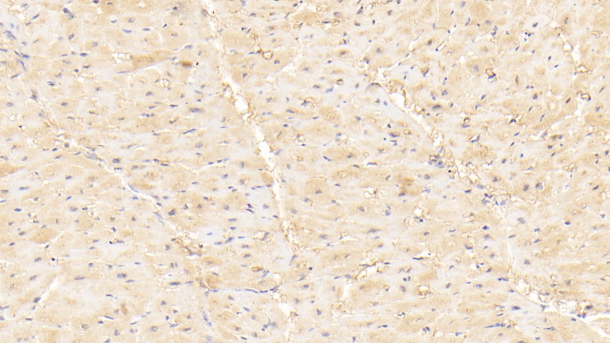 Polyclonal Antibody to Myosin Light Chain Kinase 3 (MYLK3)