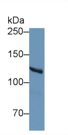 Polyclonal Antibody to Myosin IE (MYO1E)