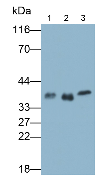 Polyclonal Antibody to Tropomyosin 2 Beta (TPM2)