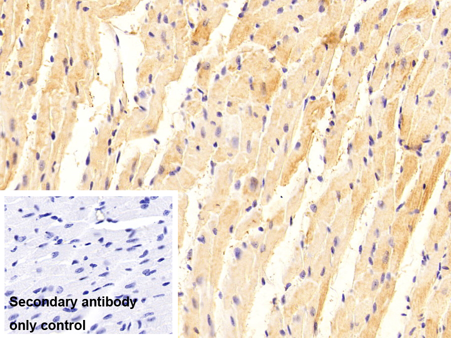 Polyclonal Antibody to Tropomyosin 2 Beta (TPM2)