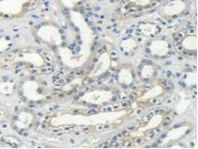Polyclonal Antibody to Myosin Heavy Chain 14, Non Muscle (MYH14)