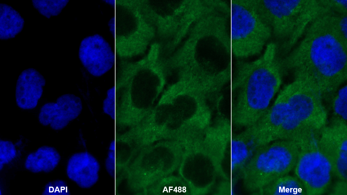 Polyclonal Antibody to Myosin Heavy Chain 14, Non Muscle (MYH14)