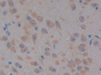 Polyclonal Antibody to Pyruvate Dehydrogenase Kinase Isozyme 2 (PDK2)