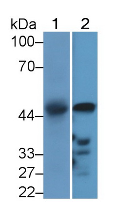 Polyclonal Antibody to Pyruvate Dehydrogenase Kinase Isozyme 2 (PDK2)