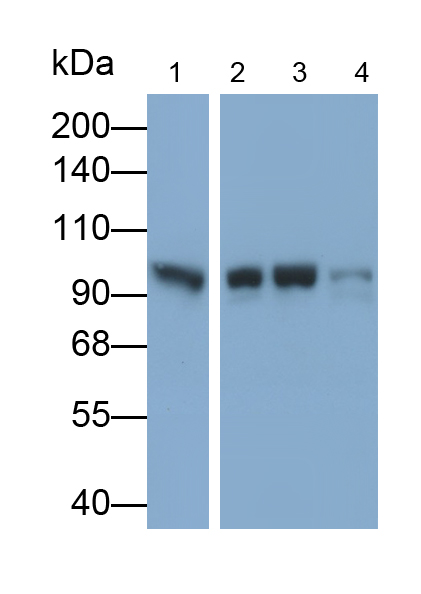 Polyclonal Antibody to Aryl Hydrocarbon Receptor Nuclear Translocator (ARNT)
