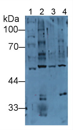 Polyclonal Antibody to Heat Shock 70kDa Protein 14 (HSPA14)