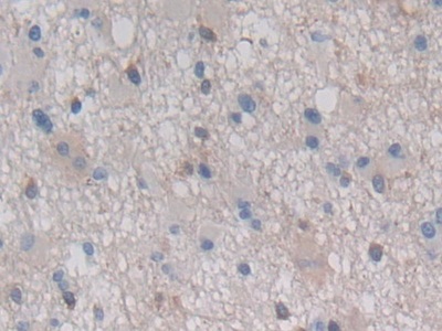 Polyclonal Antibody to Heat Shock Protein Beta 7 (HSPb7)