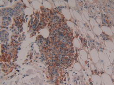 Polyclonal Antibody to Cytochrome P450 27B1 (CYP27B1)