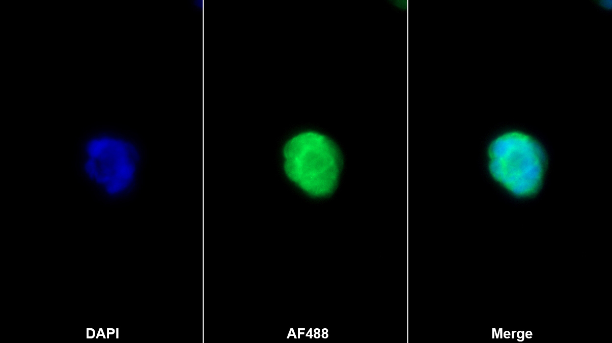 Polyclonal Antibody to Cytochrome P450 27B1 (CYP27B1)