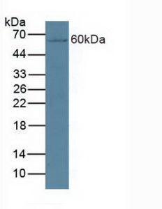 Polyclonal Antibody to Cytochrome P450 27B1 (CYP27B1)