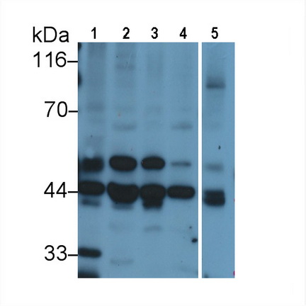 Polyclonal Antibody to Mitogen Activated Protein Kinase Kinase 2 (MAP2K2)