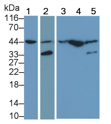 Polyclonal Antibody to Mitogen Activated Protein Kinase Kinase 2 (MAP2K2)