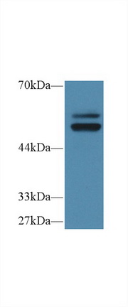 Polyclonal Antibody to Protein Tyrosine Phosphatase, Non Receptor Type 5 (PTPN5)