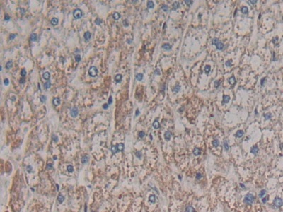 Polyclonal Antibody to ATP Binding Cassette Transporter C4 (ABCC4)