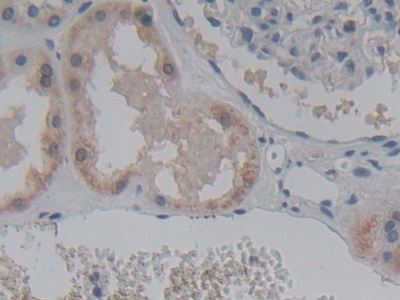 Polyclonal Antibody to ATP Binding Cassette Transporter C8 (ABCC8)