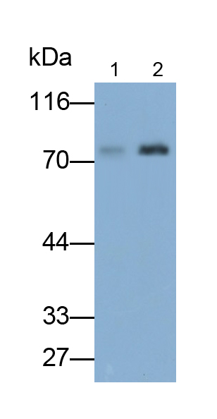 Polyclonal Antibody to Acyl Coenzyme A Synthetase Long Chain Family, Member 1 (ACSL1)
