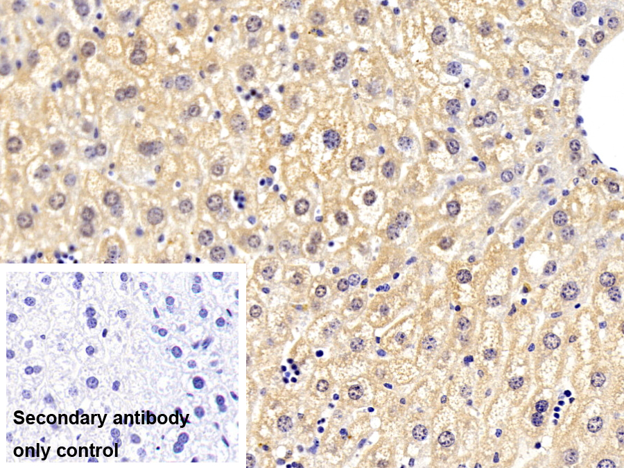 Polyclonal Antibody to Dodecenoyl Coenzyme A Delta Isomerase (DCI)