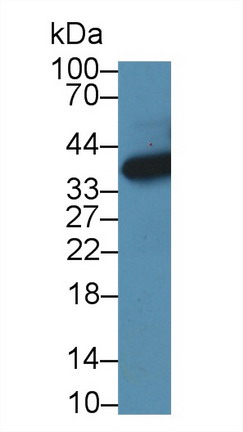 Polyclonal Antibody to 3-Hydroxyisobutyryl Coenzyme A Hydrolase (HIBCH)