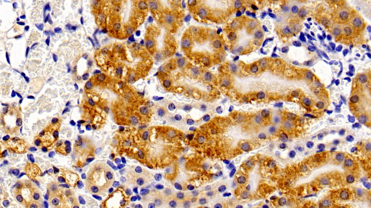 Polyclonal Antibody to Peroxisomal D3, D2-Enoyl Coenzyme A Isomerase (PECI)