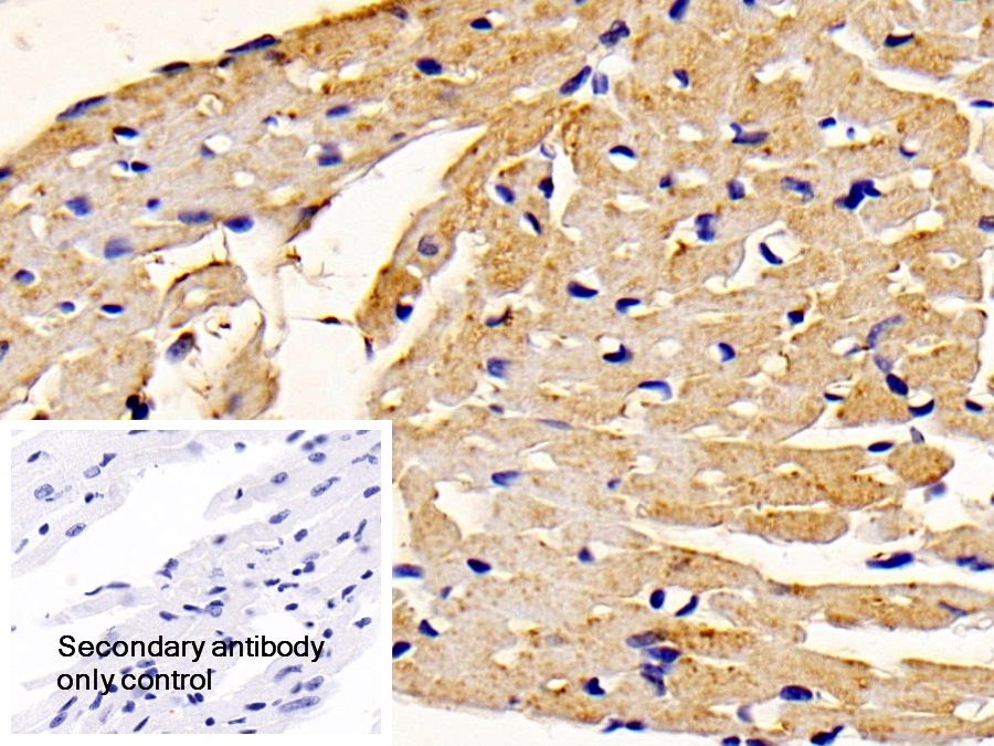 Polyclonal Antibody to Peroxisomal D3, D2-Enoyl Coenzyme A Isomerase (PECI)