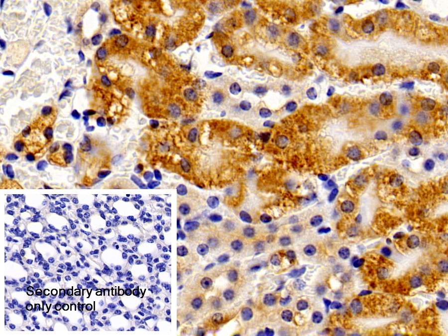 Polyclonal Antibody to Peroxisomal D3, D2-Enoyl Coenzyme A Isomerase (PECI)