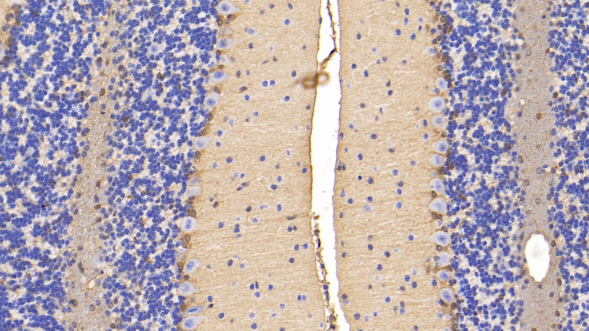 Polyclonal Antibody to Diazepam Binding Inhibitor (DBI)