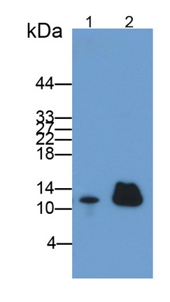 Polyclonal Antibody to Diazepam Binding Inhibitor (DBI)