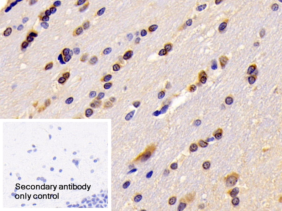 Polyclonal Antibody to Regulator Of G Protein Signaling 6 (RGS6)