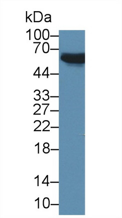 Polyclonal Antibody to Pyruvate Dehydrogenase Phosphatase 2 (PDP2)