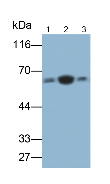 Polyclonal Antibody to Lipolysis Stimulated Lipoprotein Receptor (LSR)