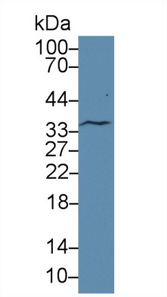 Polyclonal Antibody to Low Density Lipoprotein Receptor Related Protein 11 (LRP11)