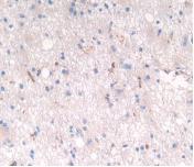 Polyclonal Antibody to Low Density Lipoprotein Receptor Related Protein 4 (LRP4)