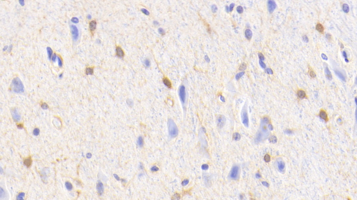 Polyclonal Antibody to Glutamine synthetase (GS)