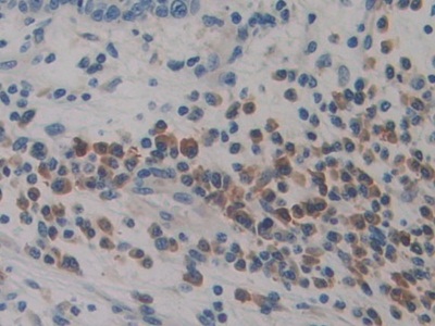 Polyclonal Antibody to Preprovasopressin (VP)