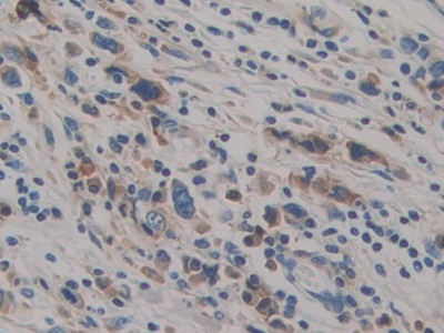 Polyclonal Antibody to Preprovasopressin (VP)