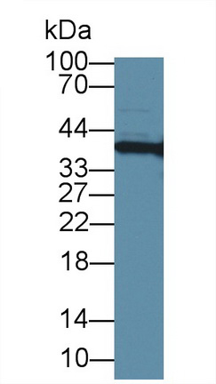 Polyclonal Antibody to High Mobility Group Protein 20B (HMG20B)