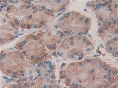 Polyclonal Antibody to Protein Disulfide Isomerase A4 (PDIA4)