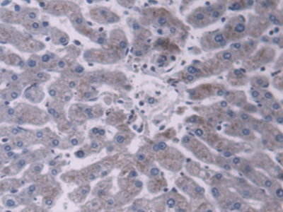 Polyclonal Antibody to Protein Disulfide Isomerase A5 (PDIA5)