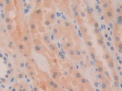 Polyclonal Antibody to D-Dopachrome Tautomerase (DDT)